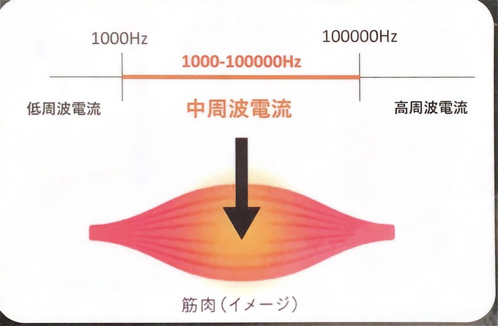 電気バリブラシ界隈に衝撃！ONCEのEMS Care Proがすごい！！ – 雨と